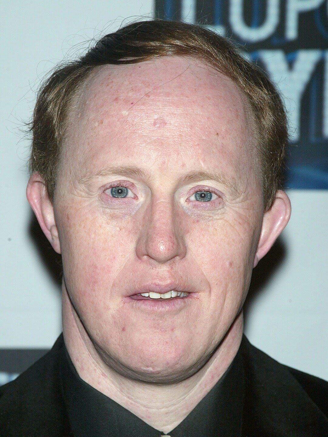 Chris Burke